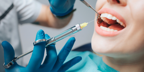 Anesthesia for Dental Implants