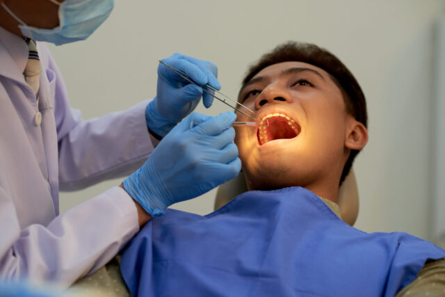 Wisdom tooth extraction